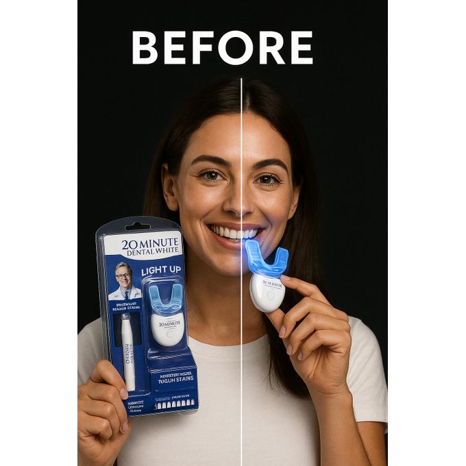 Kit de Blanchiment Dentaire LED – Sourire Plus Éclatant